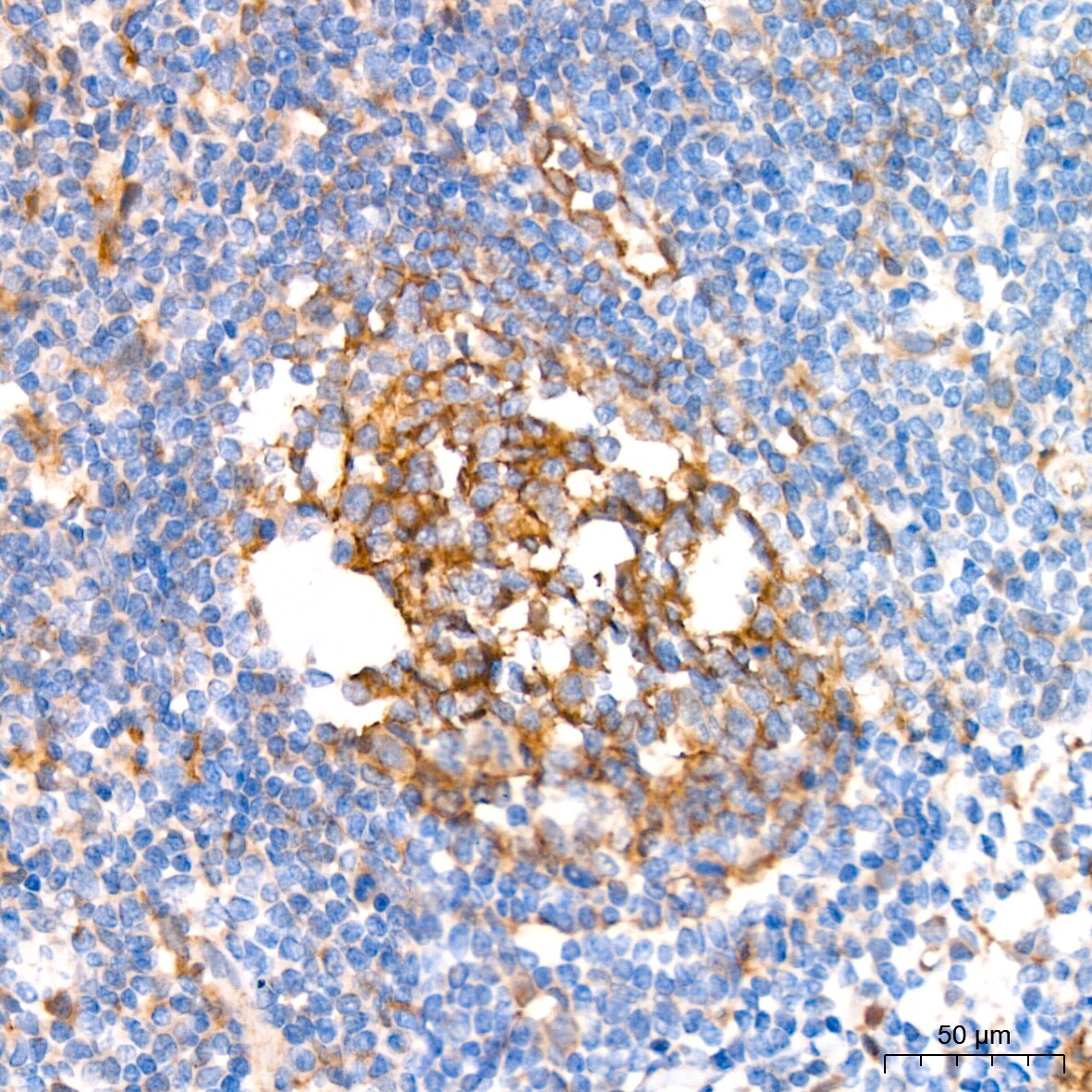 Syntenin 1 Antibody (3J5O6)