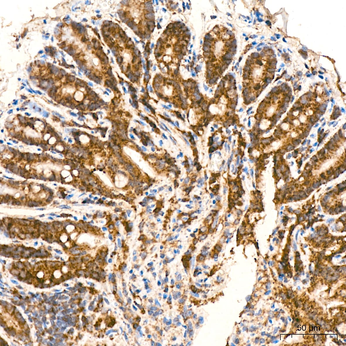 HSP10/EPF Antibody (0H0X6)