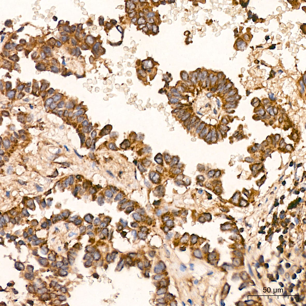 HSP10/EPF Antibody (0H0X6)