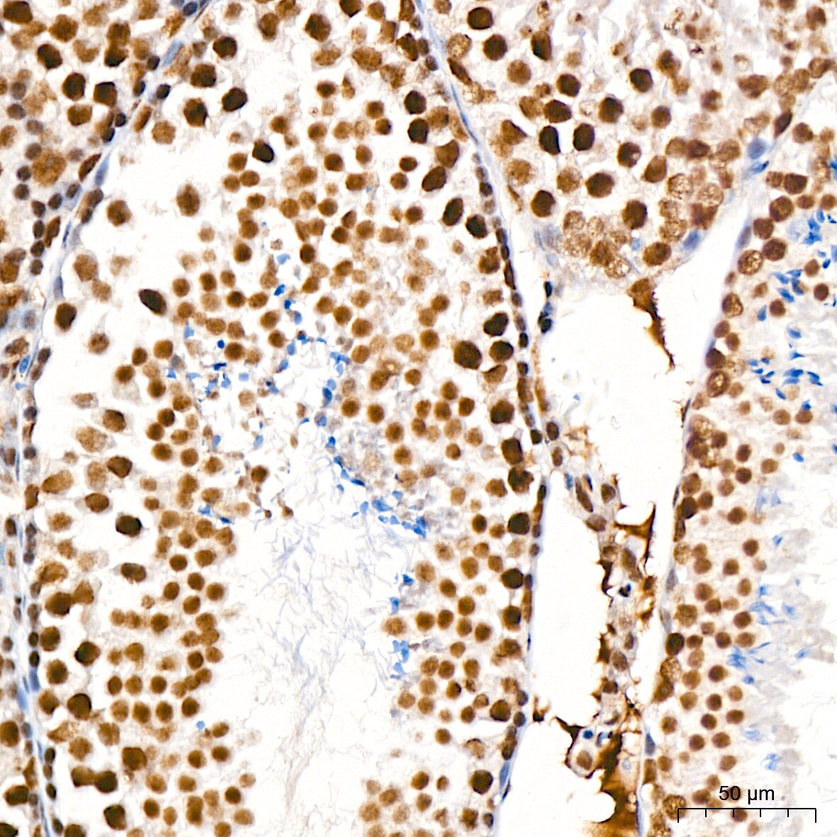DDX17 Antibody (2U1P0)