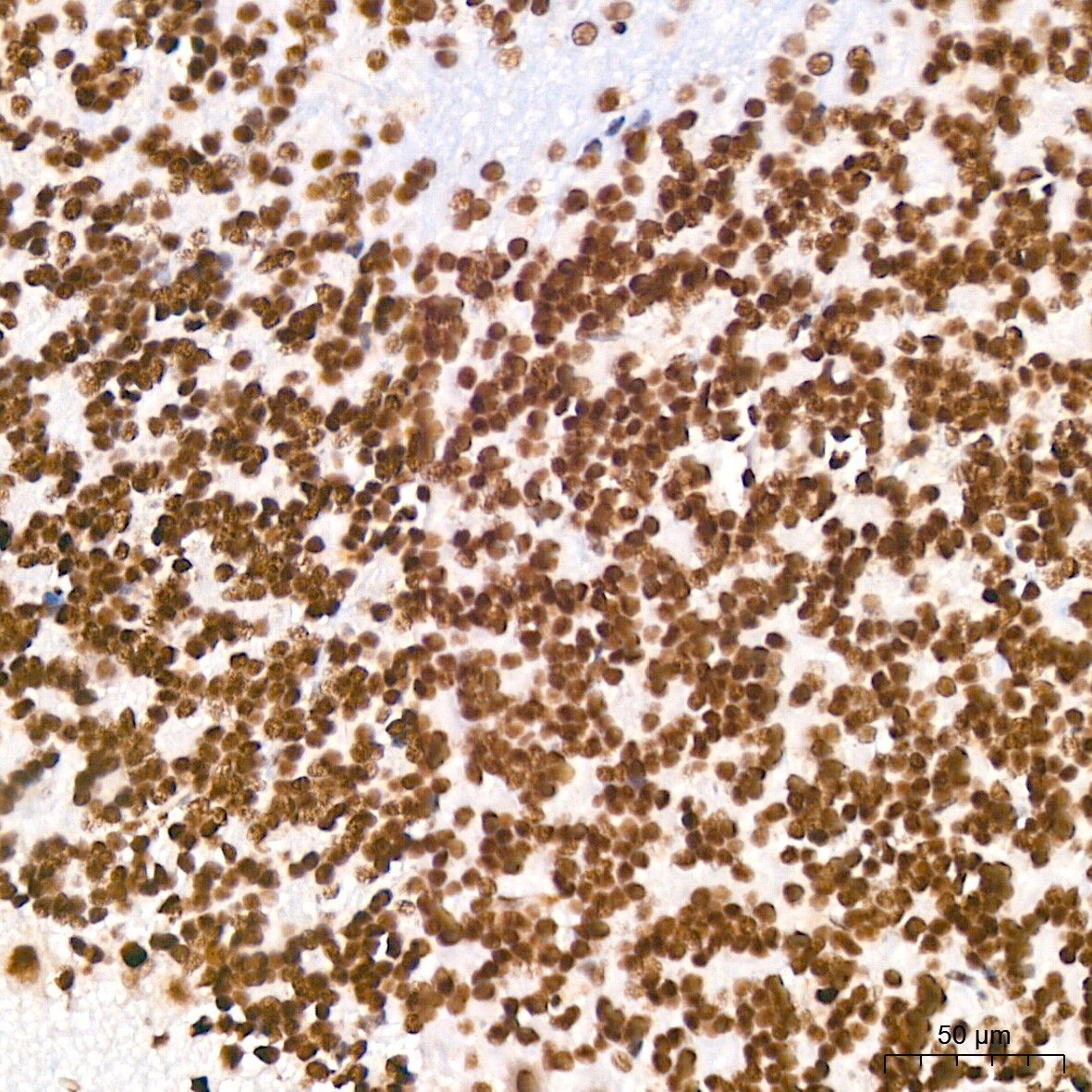 DDX17 Antibody (2U1P0)