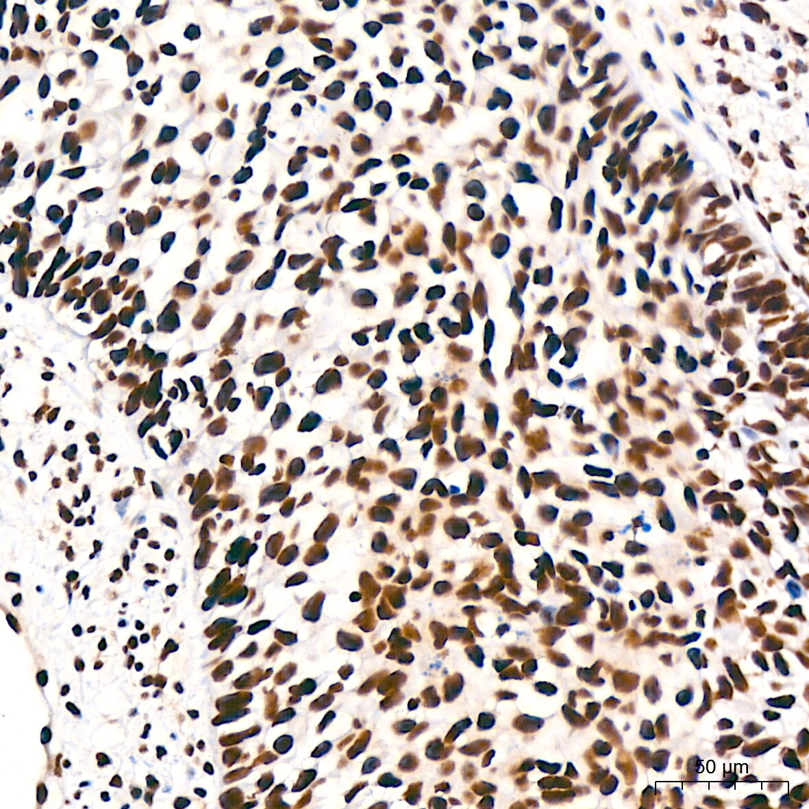 DDX17 Antibody (2U1P0)