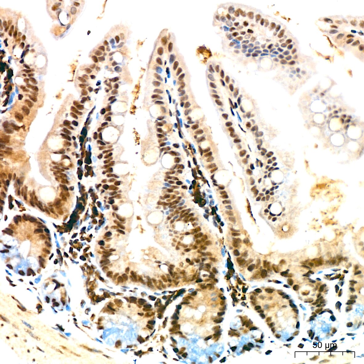 DDX17 Antibody (2U1P0)