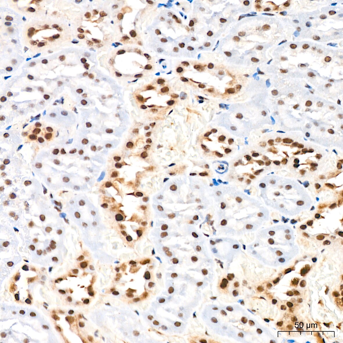 DDX17 Antibody (2U1P0)