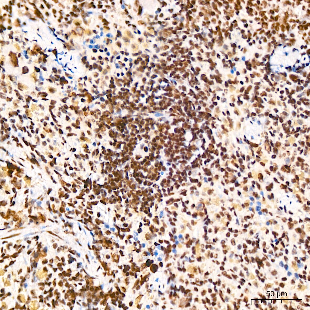 DDX17 Antibody (2U1P0)
