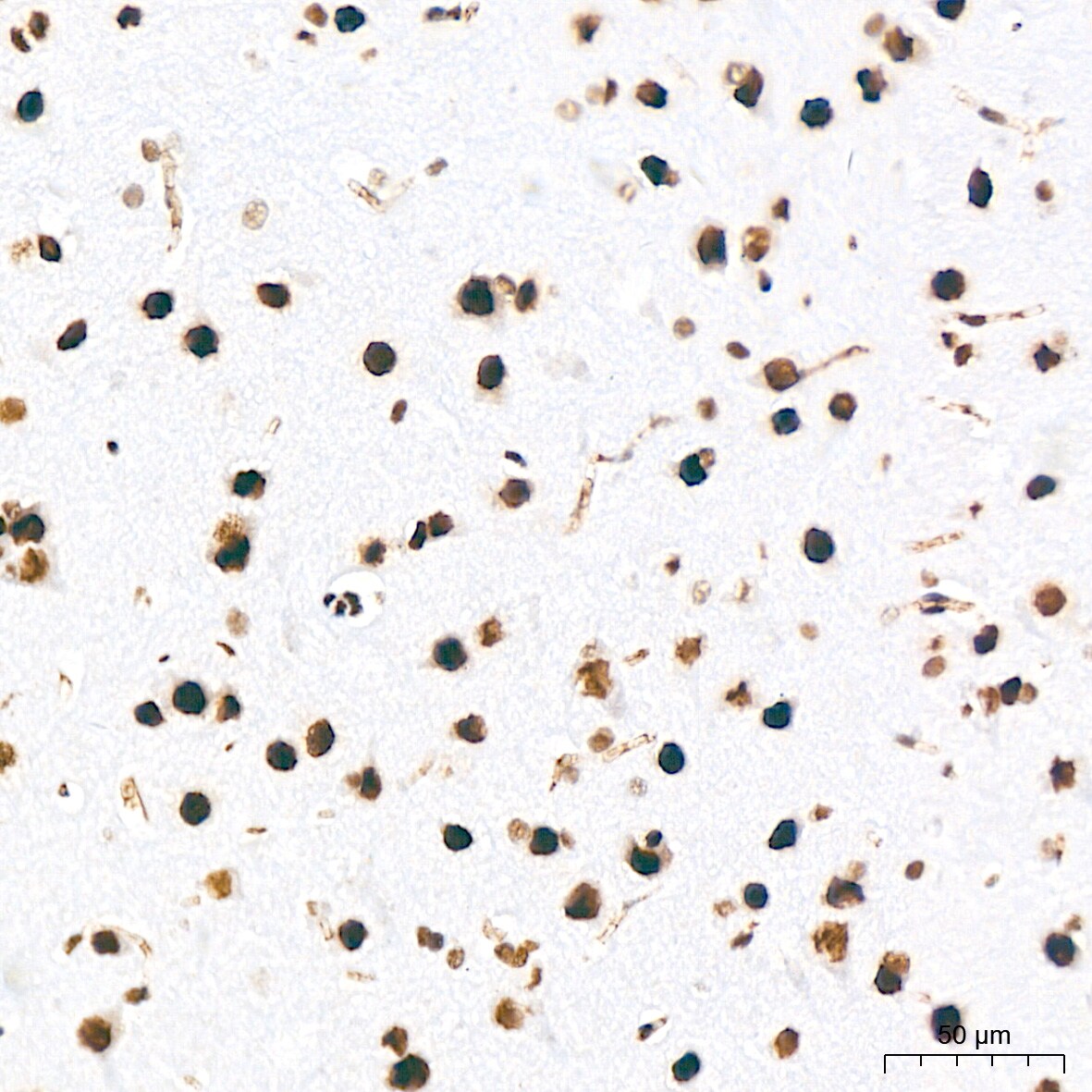 DDX17 Antibody (2U1P0)