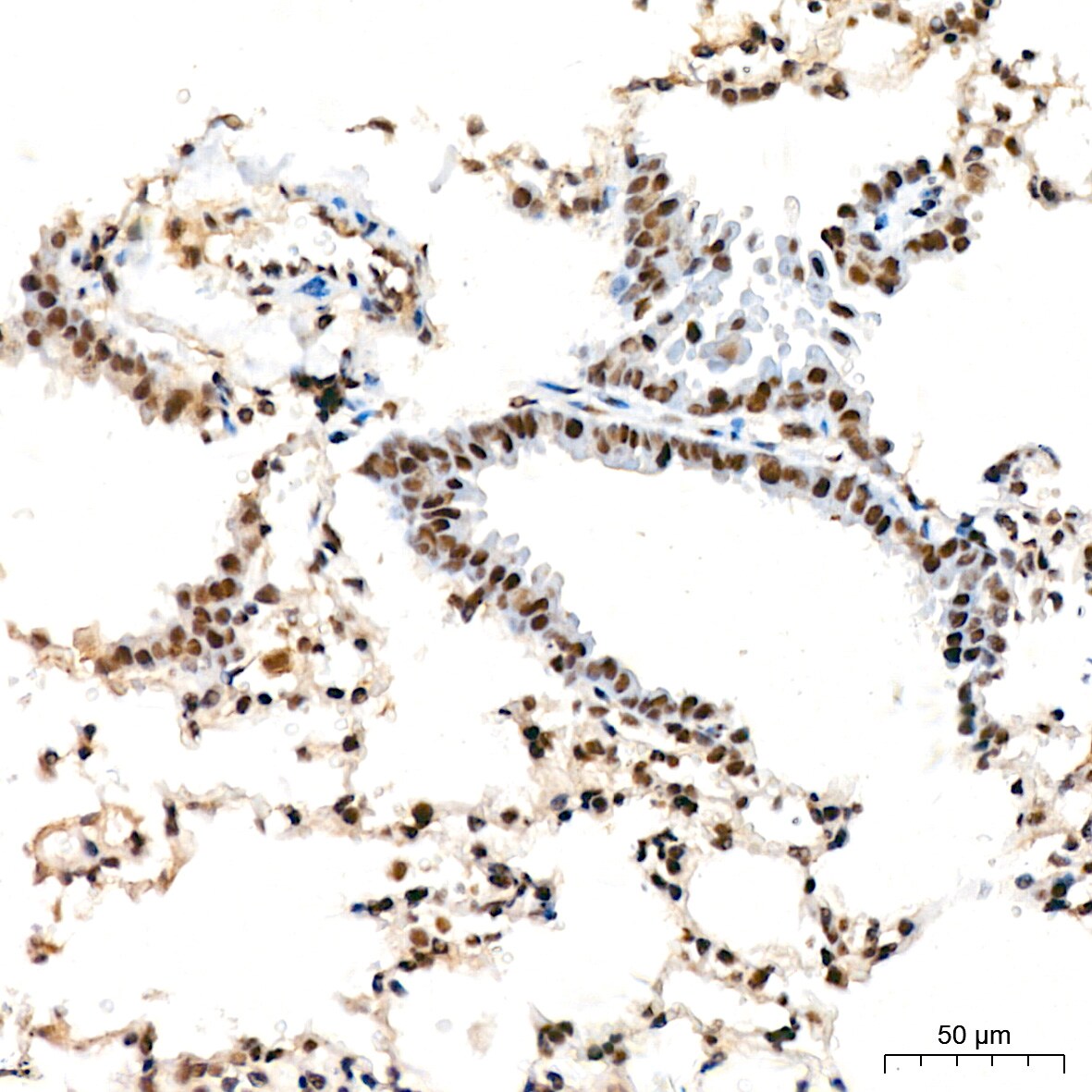 DDX17 Antibody (2U1P0)