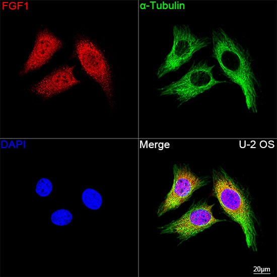 FGF acidic/FGF1 Antibody (3X3E5)