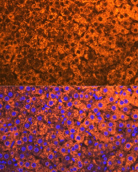 Cytochrome P450 2D6 Antibody (1X3F0)