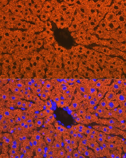 Cytochrome P450 2D6 Antibody (1X3F0)