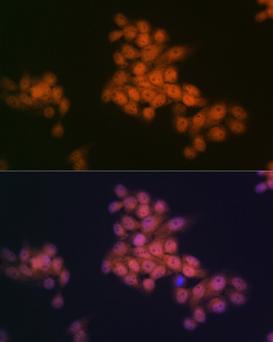 WAPL Antibody (3Q4G1)