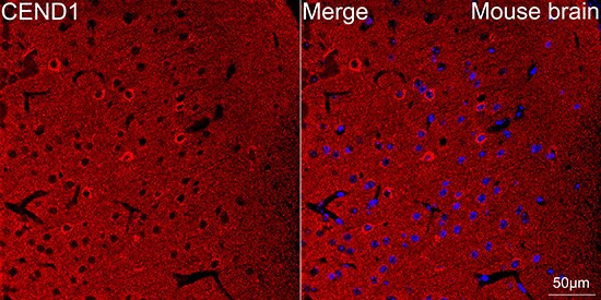 CEND1 Antibody (1D3Z1)
