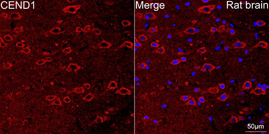 CEND1 Antibody (1D3Z1)