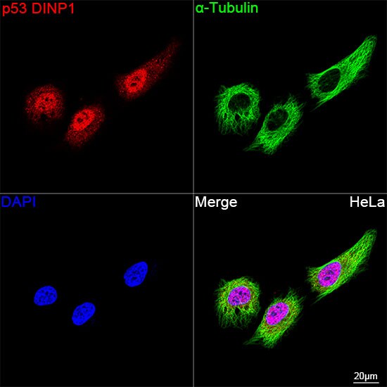 p53 DINP1 Antibody (9Y6Z7)