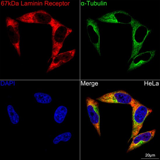 RPSA Antibody (2Q8Q6)