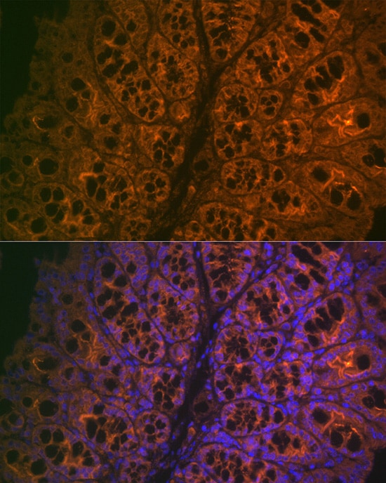 CEACAM6/CD66c Antibody (4Z3V7)