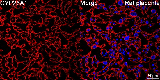 CYP26A1 Antibody (1E1D2)