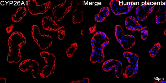 CYP26A1 Antibody (1E1D2)