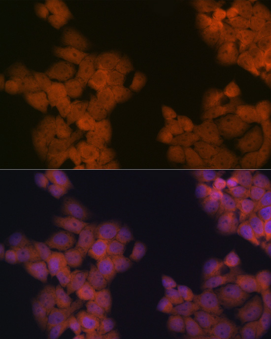 Cdc23 Antibody (1Q2I3)