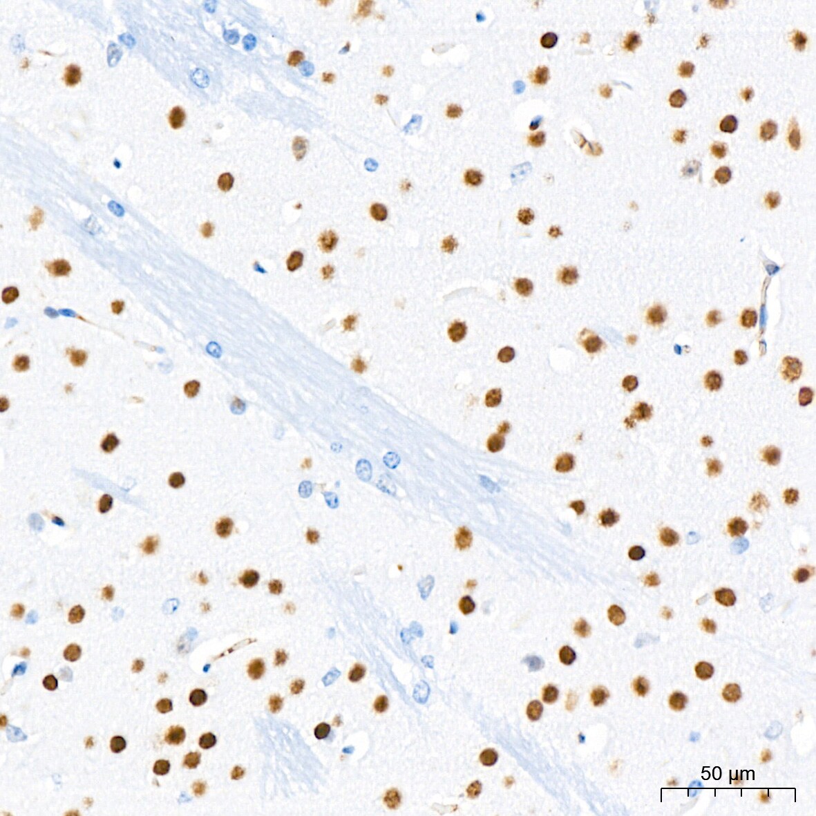 CHD3 Antibody (8Z6L6)
