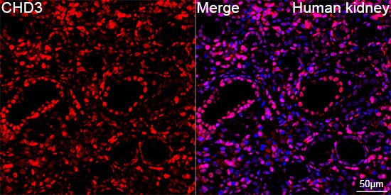 CHD3 Antibody (8Z6L6)