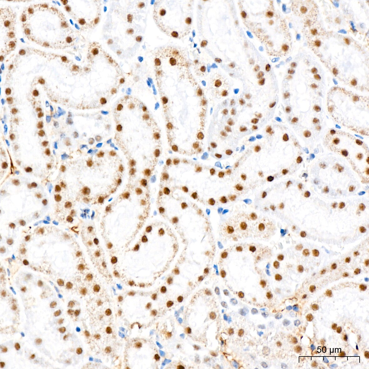 CHD3 Antibody (8Z6L6)