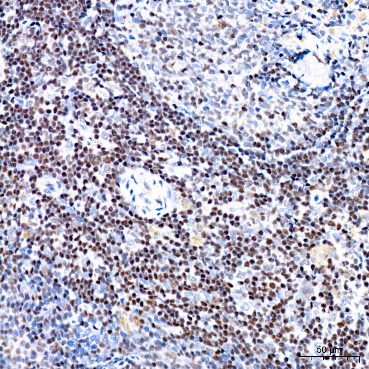 CHD3 Antibody (8Z6L6)
