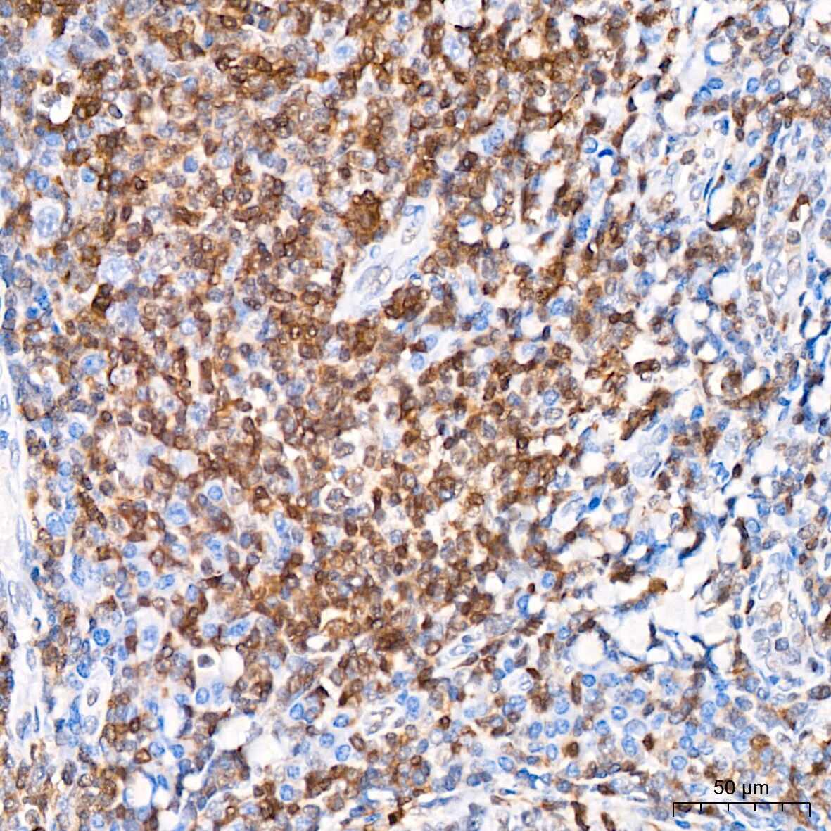 CHD3 Antibody (8Z6L6)