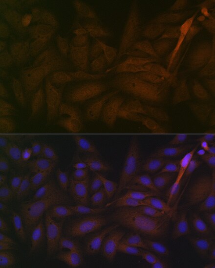 PP2A alpha/beta Antibody (4J2Z8)