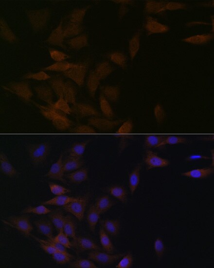 PP2A alpha/beta Antibody (4J2Z8)