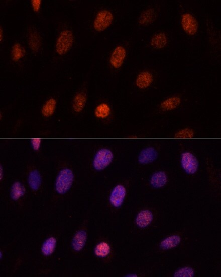 PCGF1 Antibody - Azide and BSA Free