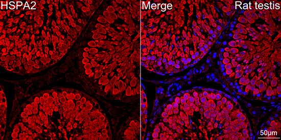 HSPA2 Antibody (5C9X0)