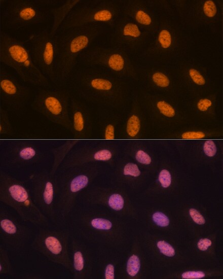 JMJD2B Antibody (8I0I1)