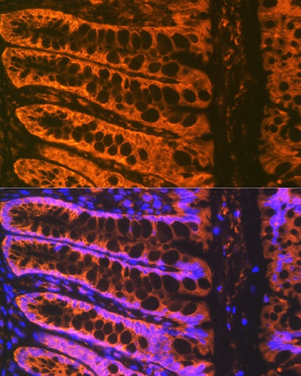 ADAM15 Antibody (4T4X10)