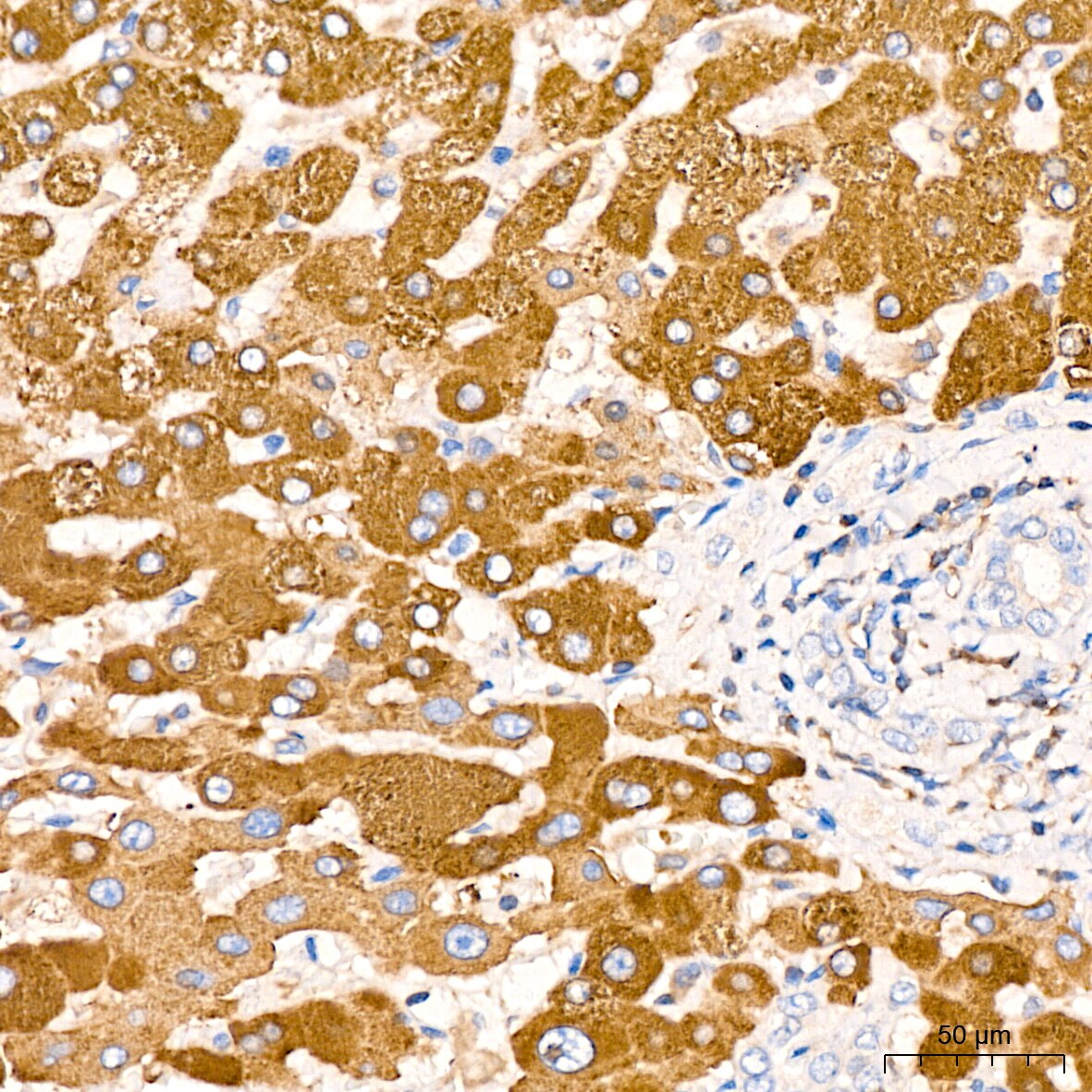 ADAM15 Antibody (4T4X10)