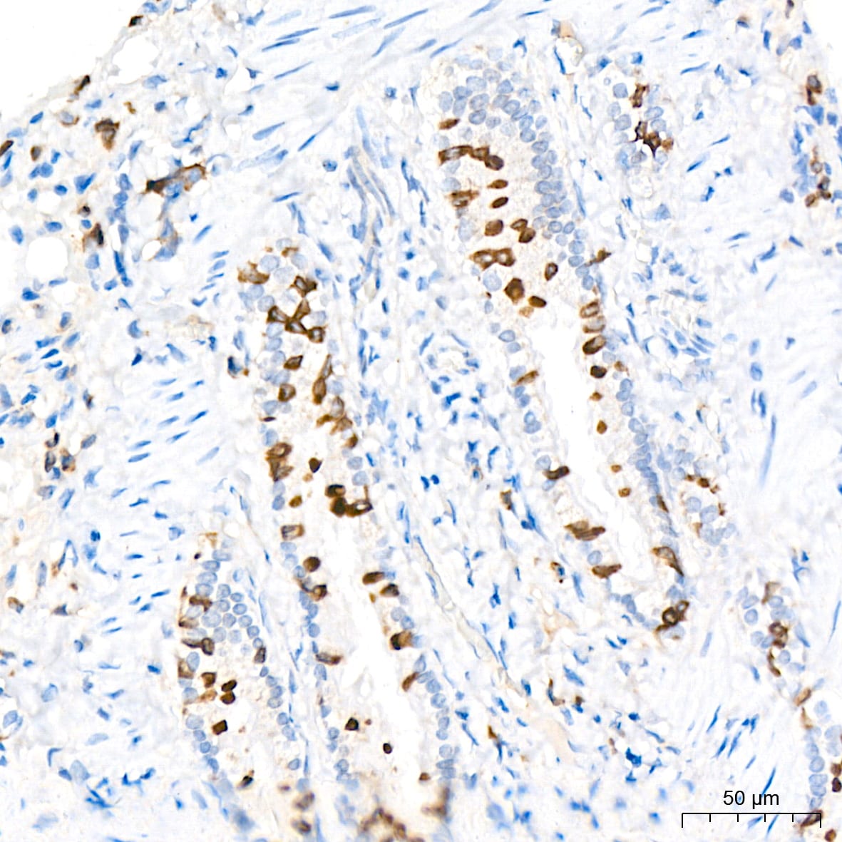 ADAM15 Antibody (4T4X10)