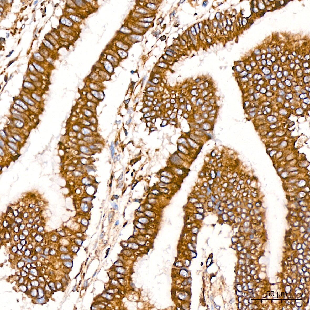 ADAM15 Antibody (4T4X10)