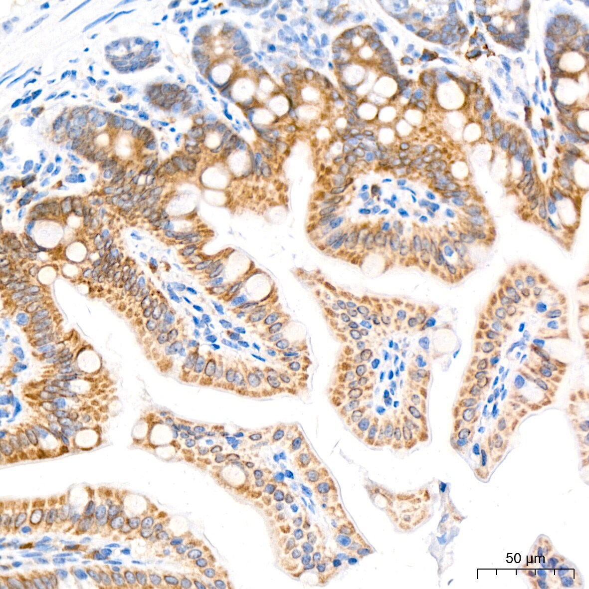 ADAM15 Antibody (4T4X10)