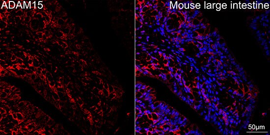 ADAM15 Antibody (4T4X10)