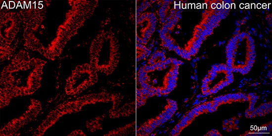 ADAM15 Antibody (4T4X10)
