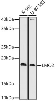 LMO2 Antibody (9O5X9)