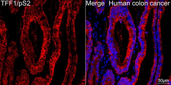 TFF1/pS2 Antibody (6P6R7)