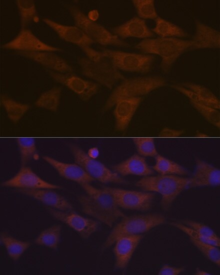 PKC delta Antibody (7I5U6)