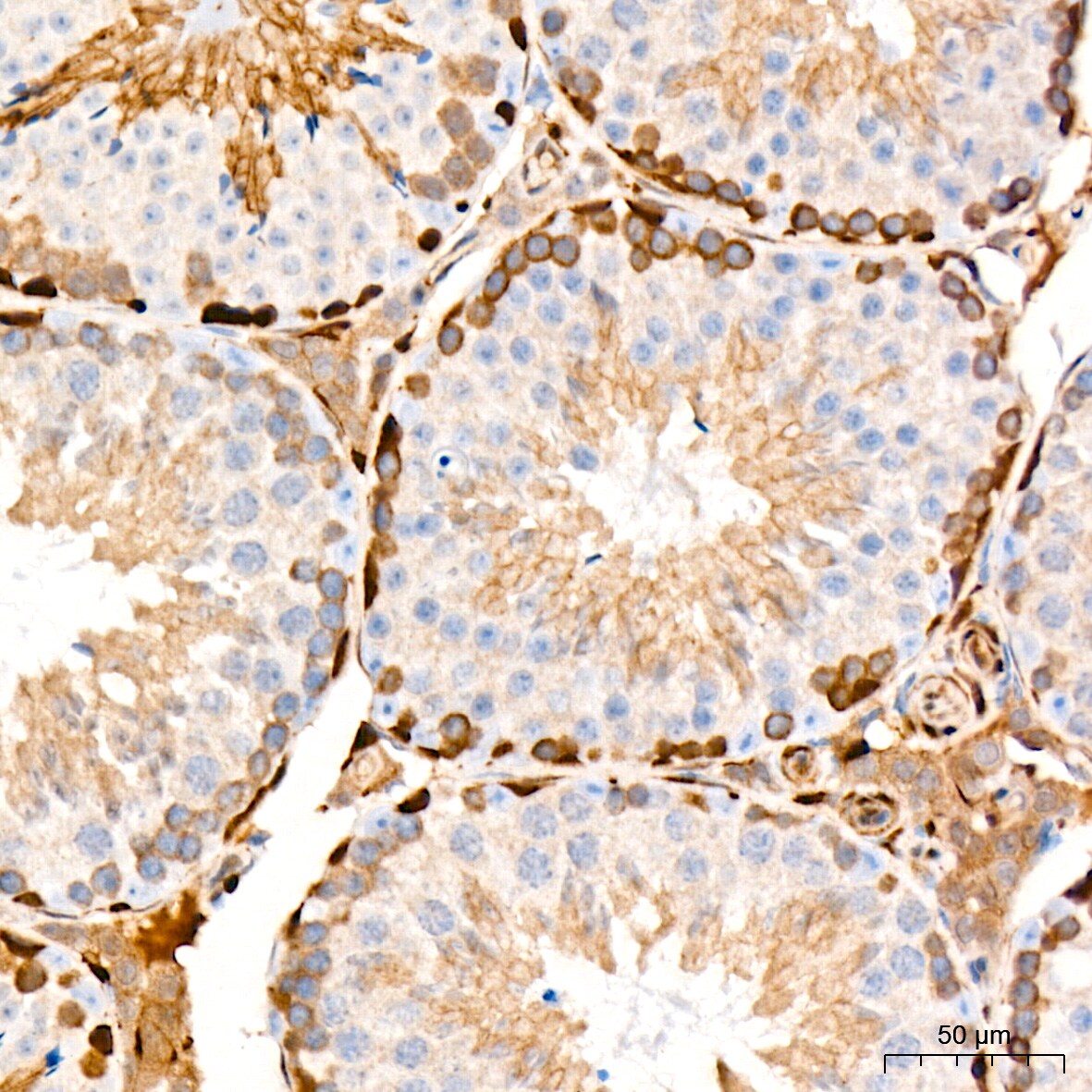 PKC delta Antibody (7I5U6)