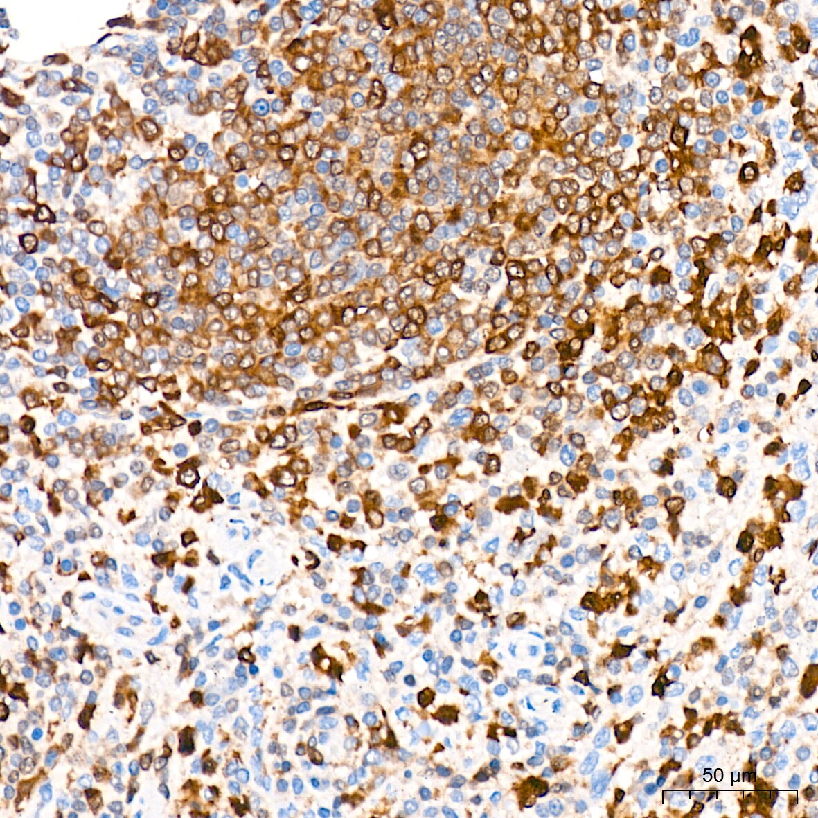 PKC delta Antibody (7I5U6)