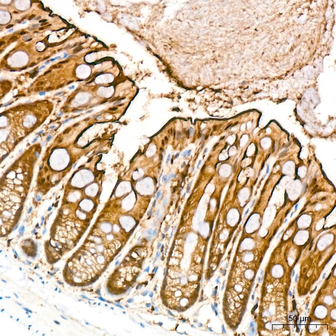 PKC delta Antibody (7I5U6)