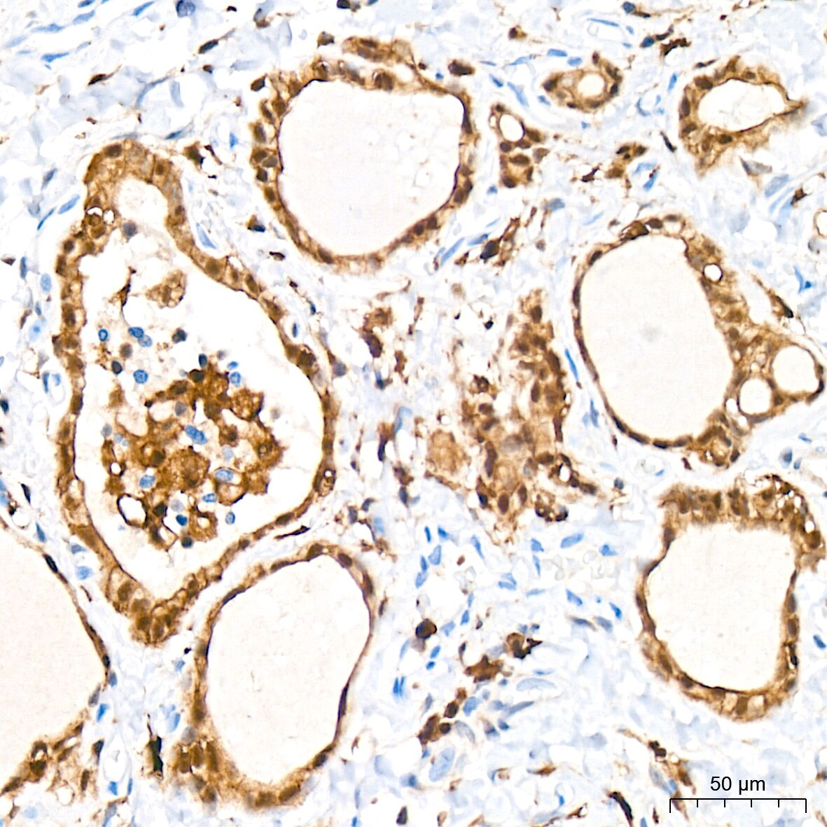 PKC delta Antibody (7I5U6)