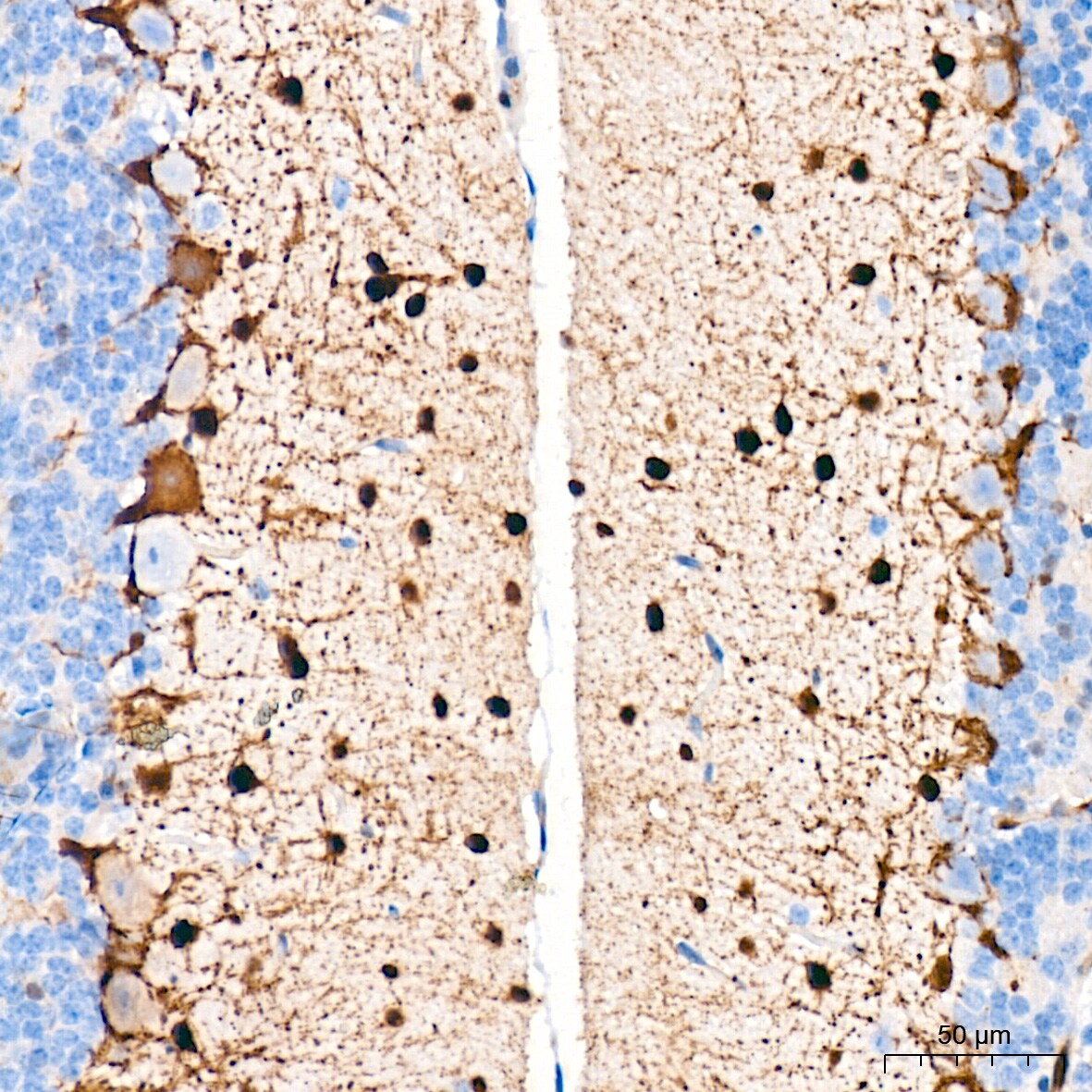 PKC delta Antibody (7I5U6)