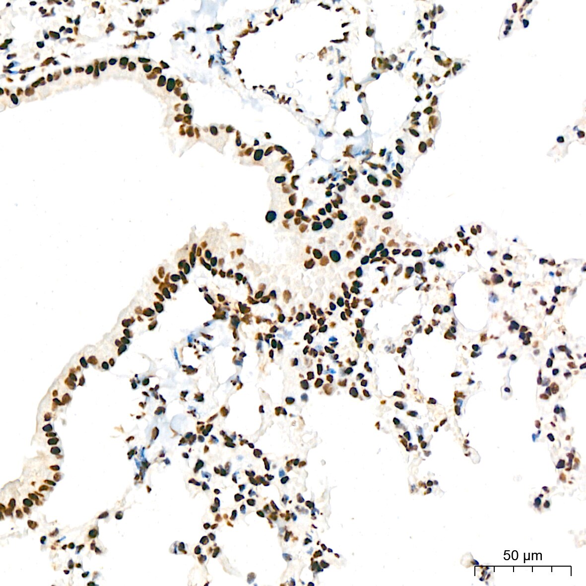 ILF3 Antibody (0S2N7)