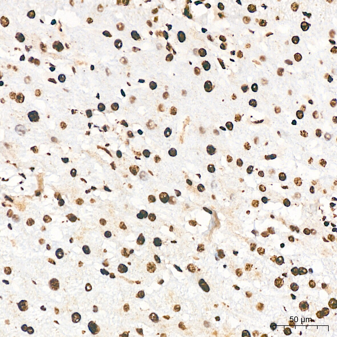 ILF3 Antibody (0S2N7)